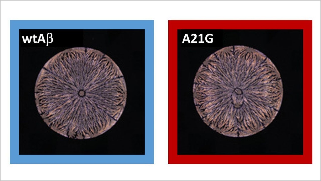 Neuronale Netzwerke erkennen kleinste Unterschiede in den Trocknungsmustern von Peptid-Lösungen (links: Amyloid-beta-(Aβ42)-Peptid, rechts: Mutation).