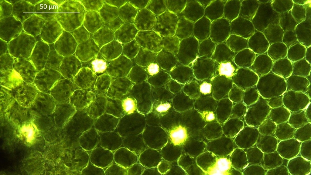 Zellen eines Oleanderblatts im Polarisationsmikroskop. Oft sind die Zellen jedoch zu einem formlosen Brei verdaut. Hier hilft dann nur noch das von den Forschenden des KIT entwickelte DNA-Fingerabdruckverfahren. 