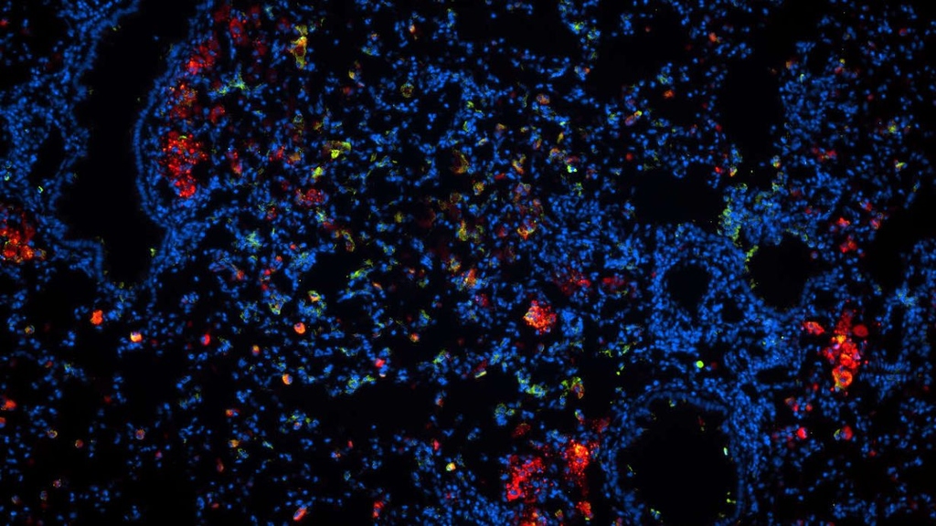 Die Mikroskopaufnahme eines Lungenschnittes einer mit TB infizierten Maus zeigt in Rot die Wirkstoff-Nanopartikel. Ausführliche Bildunterschrift am Textende. (Abbildung: FZB Zelluläre Mikrobiologie, Dr. N. Redinger).