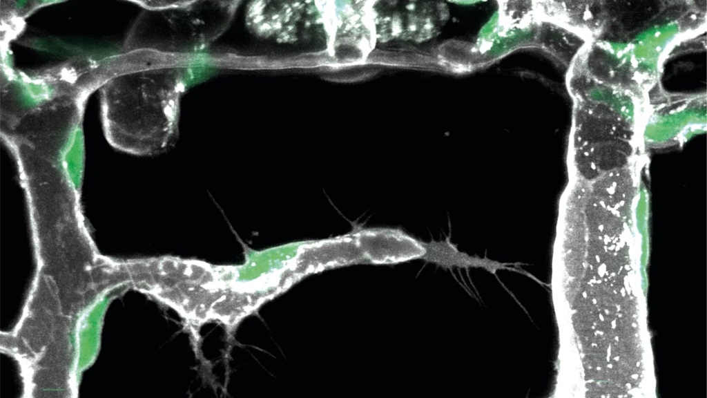 Molekularer Code regt Pionierzellen zum Aufbau von Blutgefäßen im Körper an