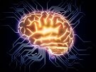 Nanoelektroden, die mit Beteiligung des KIT entwickelt wurden, könnten bei der Behandlung neurologischer Erkrankungen helfen, indem sie das Gehirn stimulieren. (Grafik: Mopic – Fotolia) 