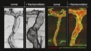 Darstellung natürlich wachsender lebender Arterien und fluoreszenzmikroskopische Darstellung des Blutflusses und des endothelialen Aktin Zytoskeletts. Ausführliche Bildbeschreibung am Textende. (Abb.: ZOO, KIT)