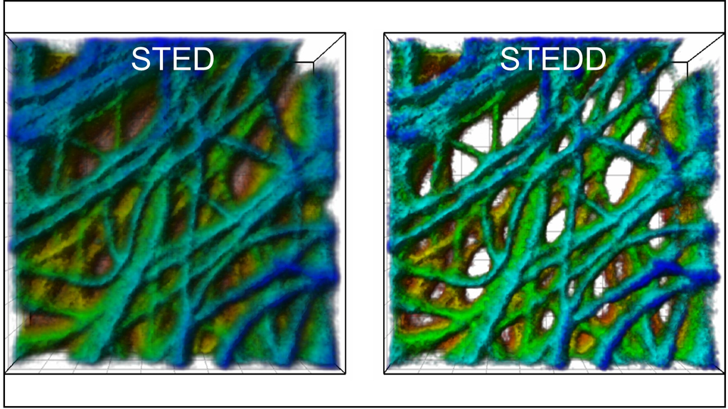 Eine Krebszelle unter dem Mikroskop: STED-Bild (links) und STEDD-Bild (rechts) (Abbildung: APH/KIT)