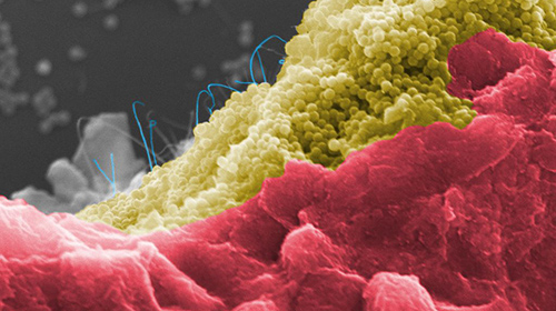 Bakterienzellen (rot) auf einem programmierbaren Kompositmaterial aus Silica-Nanopartikeln (gelb) und Kohlenstoff-Nanoröhren (blau) (Abbildung: Niemeyer-Lab, KIT)