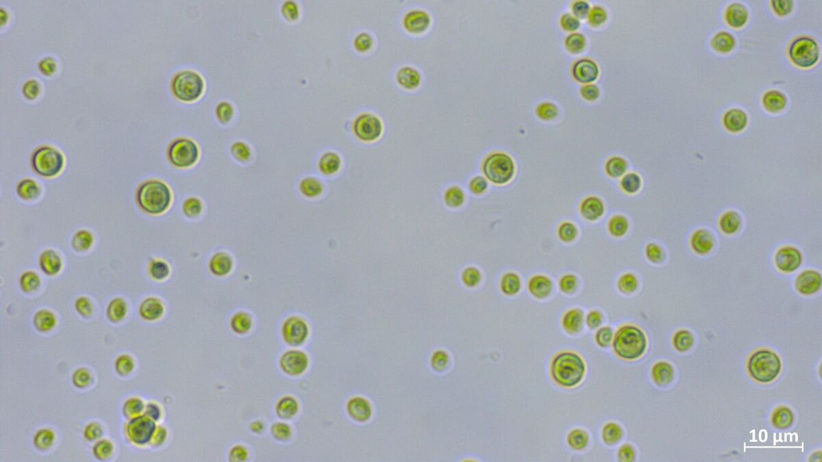 Die Alge Chlorella vulgaris  unter dem Lichtmikroskop