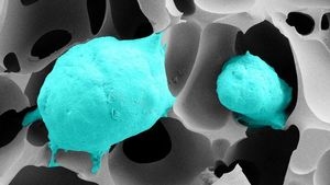 Prostatakrebszellen (grün) in einem hochporösen Cryogel mit gewebeähnlicher Elastizität (Rasterelektronenmikroskop-Aufnahme: Bettina Göppert, KIT)