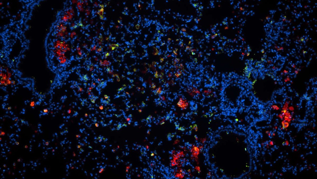 Die Mikroskopaufnahme eines Lungenschnittes einer mit TB infizierten Maus zeigt in Rot die Wirkstoff-Nanopartikel. Ausführliche Bildunterschrift am Textende