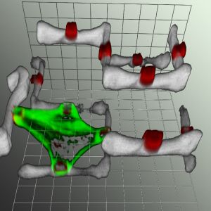 Die Aufnahme der Zelle im Zweikomponenten-Polymergerüst entstand mithilfe eines Laser-Scanning-Mikroskops (LSM). Grün gefärbt ist das Zytoskelett der Zelle, weiß wiedergegeben werden Teile des Zweikomponenten-Polymergerüstes, die "Zellgriffe" sind rot koloriert. (Bild: CFN)