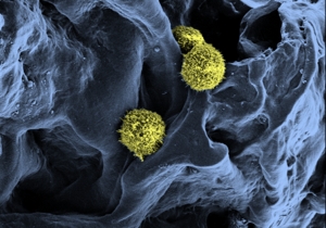 REM-Aufnahme von Stammzellen (gelb/grün) in einer Gerüststruktur (blau), die als Basis für künstliches Knochenmark dient. (Bild: C. Lee-Thedieck/KIT) 