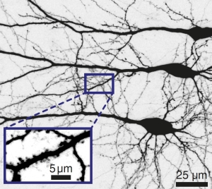 Nervenzellen bilden Netzwerke, die Signale verarbeiten können. (Bild: J. Wietek/HU Berlin)