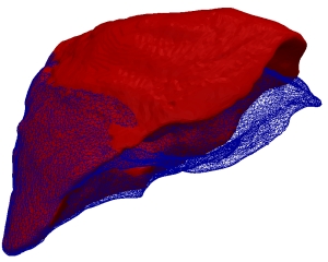 Das unverformte Lebermodell (rot) passt sich an das verformte Oberflächenprofil (blau) an. (Grafik: Dr. Stefanie Speidel, KIT, in Medical Physics, 41). 