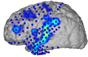 Mittels Elektrokortikographie wird Gehirnaktivität aufgezeichnet (blaue Kreise). Aus den Aktivitätsmustern (blau/gelb) lassen sich die gesprochenen Wörter erkennen (Bild: CSL/KIT) 