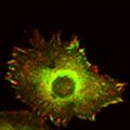 Das Protein Cadherin-11 (grün) gibt den Zellen den notwendigen Halt für ihre Wanderung. (Bild: Kashef/KIT).