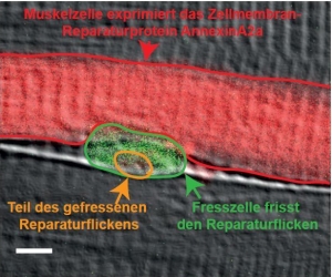 Fresszelle entfernt Reparaturflicken. Maßstab: 4 µm. (Bild: Volker Middel / KIT)