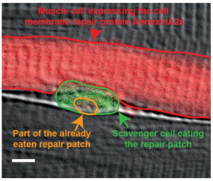 Scavenger cell removes the repair patch. Scale bar: 4 µm. (Photo: Volker Middel / KIT)