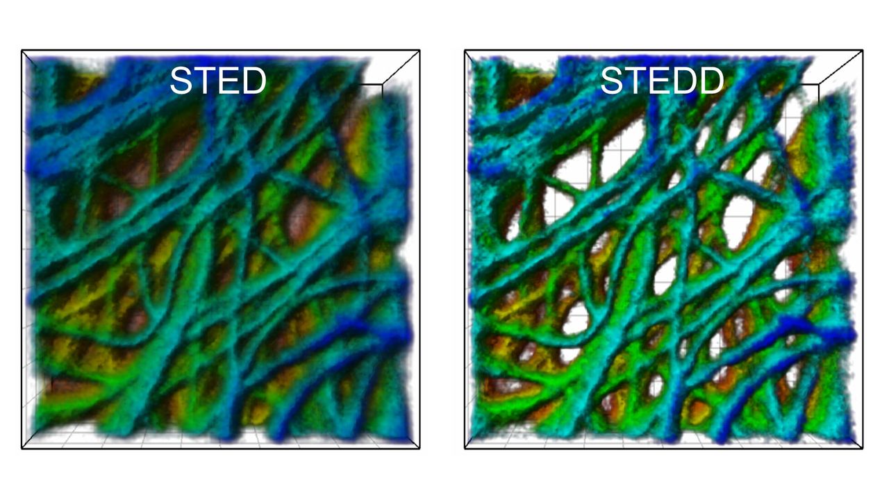 Eine Krebszelle unter dem Mikroskop: Das STED-Bild (links) weist einen niedrig aufgelösten Untergrund auf; beim STEDD-Bild (rechts) ist der Untergrund unterdrückt, sodass die Strukturen besser zu erkennen sind. (Abbildung: APH/KIT). 
