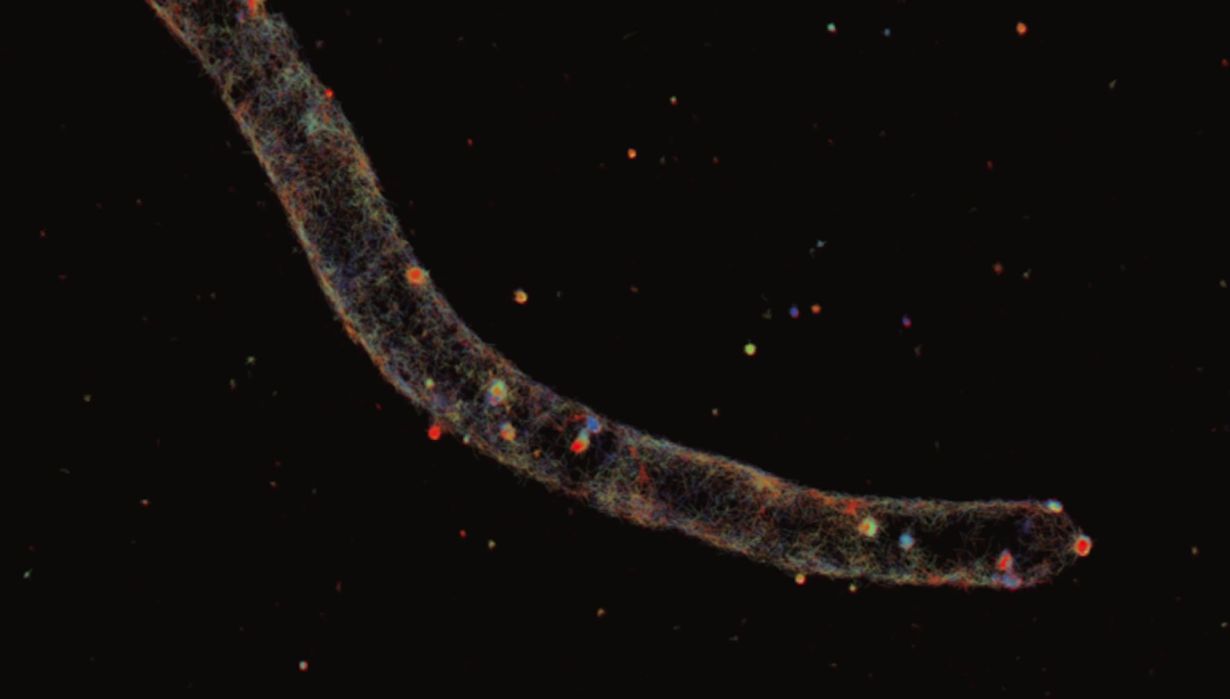  A protein (colored red) is located at the tip of a hypha of Aspergillus nidulans and controls growth. The hypha is about 3 micrometers in diameter and extends by about 1 micrometer per minute. (Photo: KIT) 