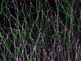 Embryonale Hirnentwicklung in der Petrischale: Axone (gruen) der Nervenzellen der Netzhaut lesen beim Wachstum mittels eines mit molekularen Antennen ausgestatteten Wachstumskegels (magenta) an ihrem Ende biochemische Signale, die sie an ihr Ziel bringen,