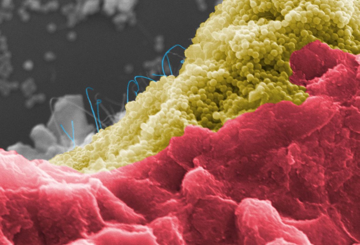 Bakterienzellen (rot) auf einem programmierbaren Kompositmaterial aus Silica-Nanopartikeln (gelb) und Kohlenstoff-Nanoröhren (blau) (Abbildung: Niemeyer-Lab, KIT)