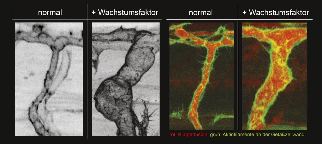 Darstellung natürlich wachsender lebender Arterien und fluoreszenzmikroskopische Darstellung des Blutflusses und des endothelialen Aktin Zytoskeletts. Ausführliche Bildbeschreibung am Textende. (Abb.: ZOO, KIT)