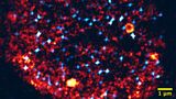 Microscopy of a nucleus: Transcription factories are colored orange, activated genes light blue. The nucleus has about one tenth of the thickness of a human hair. (Figure: Working groups Nienhaus and Hilbert, KIT) 