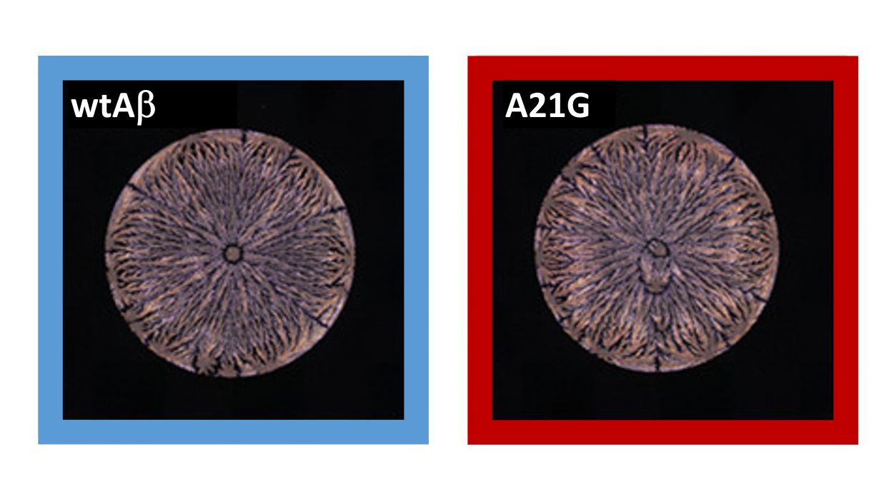 Neuronale Netzwerke erkennen kleinste Unterschiede in den Trocknungsmustern von Peptid-Lösungen (links: Amyloid-beta-(Aβ42)-Peptid, rechts: Mutation).