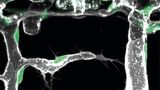 Bild einer aktiven Pionierzelle (Mitte des Bildes). Der Endothelzellkern ist grün, der Umriss der Blutgefäße grau. (Foto: Zoologisches Institut, KIT) 