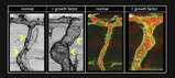 In vivo images of growing artery (A, B) and confocal images of arterial blood flow and arterial endothelial actin cytoskeleton (C, D). Detailed caption at the end of the text. (Images: ZOO, KIT)